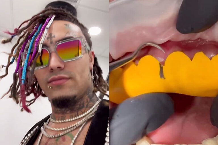 Lil Pump Spends $25,000 on New Teeth – Watch